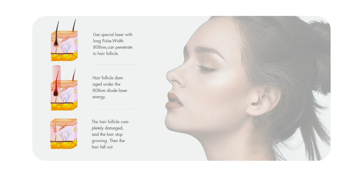 Diode Laser Hair Removal Machin (2) Diode Laser Hair Removal Machin (2)